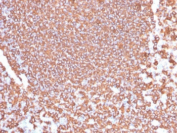 CD20 Antibody / MS4A1
