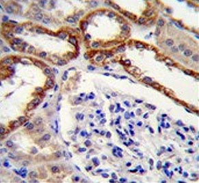 PARS2 Antibody / Prolyl-tRNA synthetase / ProRS