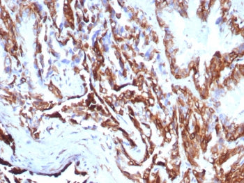 KRT7 Antibody / Cytokeratin 7