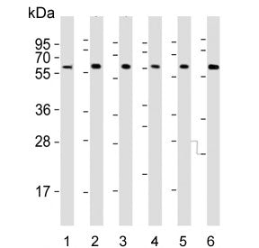 IL2RG Antibody / IL2 Receptor gamma
