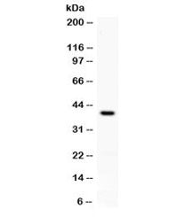 PD-L1 Antibody / B7-H1 / CD274