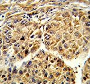 Cytochrome p450 2C19 Antibody / CYP2C19