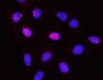 PPP2R3A Antibody