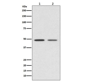 VDR Antibody / Vitamin D Receptor