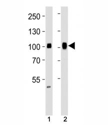 Specificity Protein 1 Antibody (SP1)