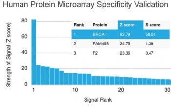 BRCA1 Antibody (Breast Marker)