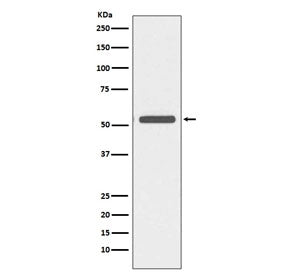 Keratin 6 Antibody / Cytokeratin 6