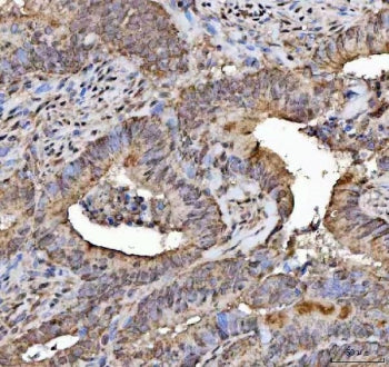 NSMF Antibody / NELF