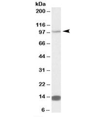 TRIM71 Antibody