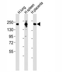 Western blot testing of MRC1L1 antibody at 1:2000 dilution and human samples: Lane 1: lung lysate; 2