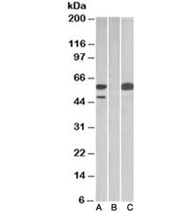 Western blot testing of HEK293 lysate overexpressing human TRIM21 with MYC tag with TRIM21 antibody