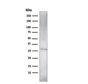 Prolactin Antibody / PRL