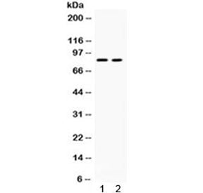 Western blot testing of human 1) HeLa and 2) HepG2 cell lysate with ZP2 antibody. Expected/observed