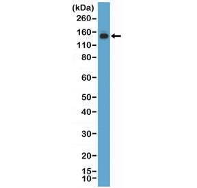 MSH6 Antibody