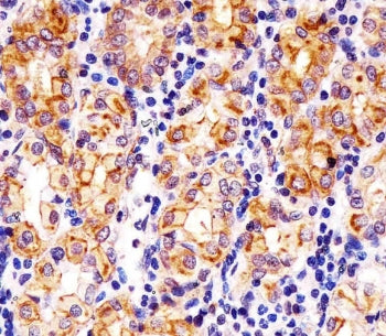 SLC22A2 Antibody / OCT2