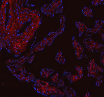 Immunofluorescent staining of FFPE human placental tissue with Collagen 1 antibody (red) and DAPI co