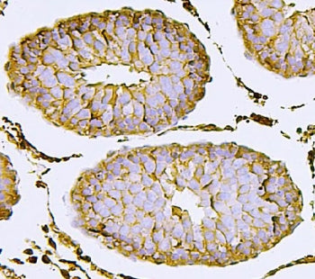 NECTIN2 Antibody / Nectin 2