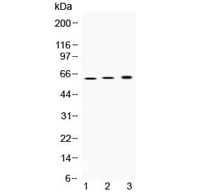 Western blot testing of 1) rat stomach, 2) mouse stomach and 3) human SGC-7901 (human gastric cancer