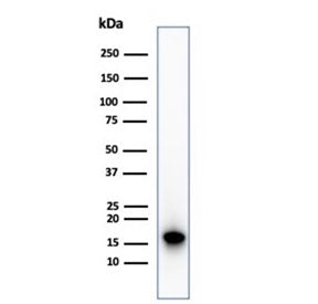 Western blot testing of human HepG2 cell lysate using recombinant p16INK4a antibody (clone CDKN2A/48