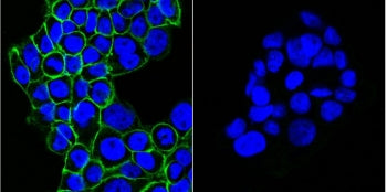Left: Immunofluorescent staining of human A431 cells with CF488-conjugated EGFR antibody (clone GFR4