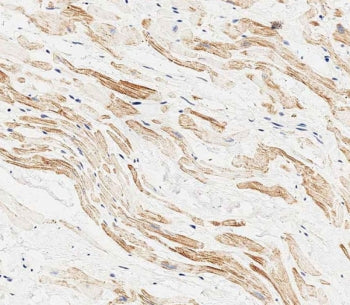 IHC testing of FFPE human heart tissue with MAP1LC3A antibody. HIER: steam section in pH6 citrate bu