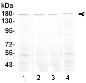 Angiotensin-converting enzyme Antibody (Ace)