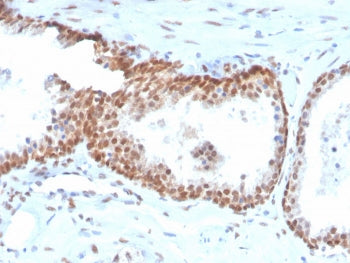 p40 / deltaNp63 Antibody
