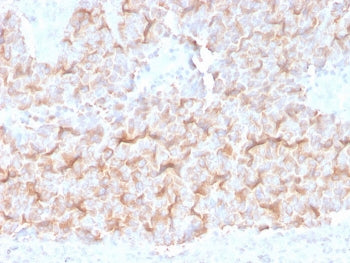 Alpha Tubulin Antibody / TUBA