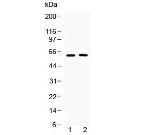 Western blot testing of human 1) COLO320 and 2) MCF7 cell lysate with Tubby antibody at 0.5ug/ml. Pr