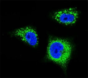 TrkA Antibody (NTRK1)
