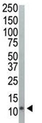 Western blot analysis of Ubiquitin antibody and HeLa cell lysate