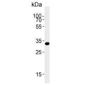 TYSY Antibody / Thymidylate Synthase