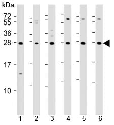 TIGIT Antibody