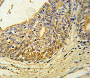 Endothelin B Receptor Antibody / EDNRB