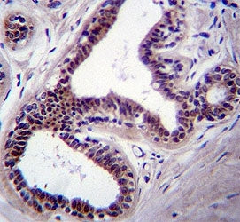 JNK Antibody