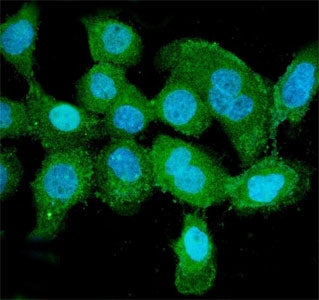 PNP Antibody / Inosine phosphorylase / Purine nucleoside phosphorylase