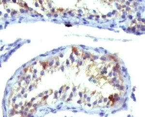 Prolactin Receptor Antibody / PRLR