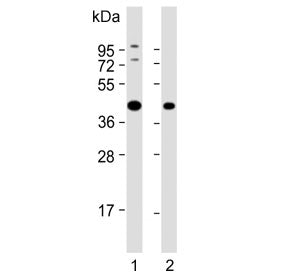 Alcohol dehydrogenase 5 Antibody / ADH5