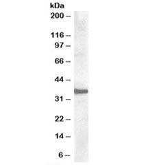 Western blot testing of human liver lysate with Apolipoprotein F antibody at 0.5ug/ml. Predicted/obs