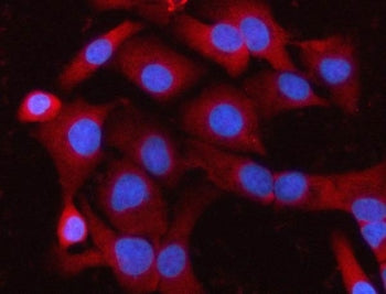 Immunofluorescent staining of FFPE human A549 cells with MELK antibody (red) and DAPI nuclear stain