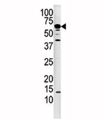 Western blot analysis of Calcineurin antibody and mouse kidney tissue lysate. Predicted molecular we