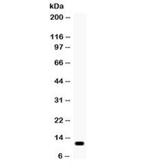 CCL2 Antibody / MCP1