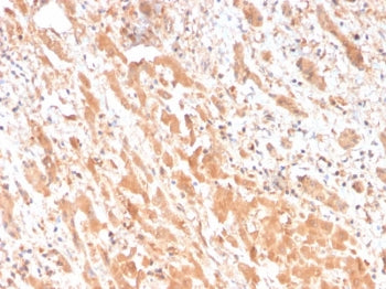 IHC staining of FFPE human liver tissue with Apolipoprotein H antibody (clone APOH/3682). HIER: boil