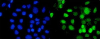 Immunofluorescent staining of FFPE human A431 cells with RBBP4 antibody (green) and DAPI nuclear sta