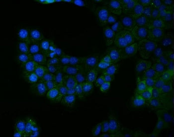 Immunofluorescent staining of FFPE human A431 cells with BCR antibody (green) and DAPI nuclear stain