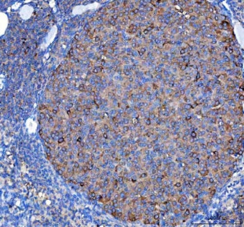 IHC staining of FFPE mouse ovary tissue with Diphosphomevalonate decarboxylase antibody. HIER: boil