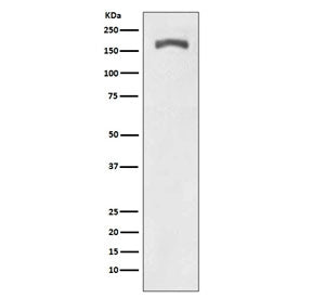 Phospho-Platelet Derived Growth Factor Receptor beta Antibody / PDGFRB (pY740)