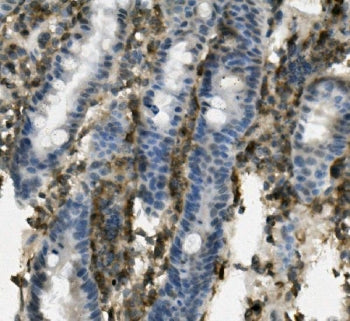 Cd162 Antibody / P selectin glycoprotein ligand 1 / PSGL-1