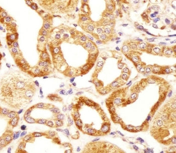 IHC testing of FFPE human kidney tissue with Hyaluronan synthase 2 antibody. HIER: steam section in