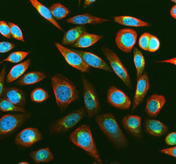 IF analysis of MSRA using anti-MSRA antibody (green) and anti-Beta Tubulin antibody (red). MSRA was